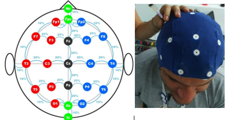 Protocolo 10/20 distancias del electrodo del sistema